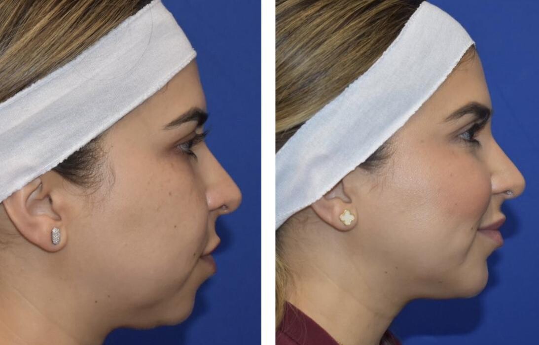 Images Facial Plastic Surgery of Austin