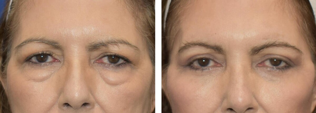 Images Facial Plastic Surgery of Austin