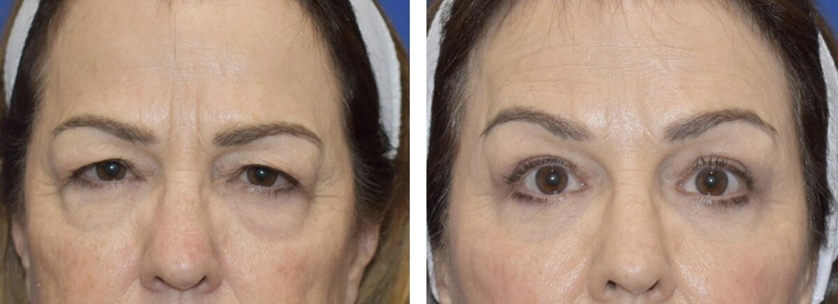Images Facial Plastic Surgery of Austin