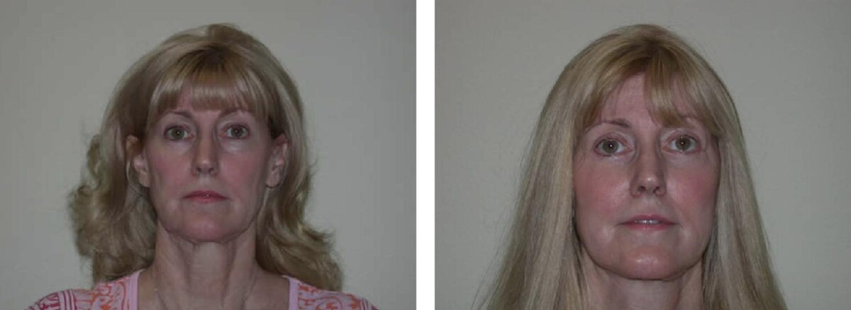Images Newport Plastic and Reconstructive Surgery Associates: Dr. Hisham M. Seify