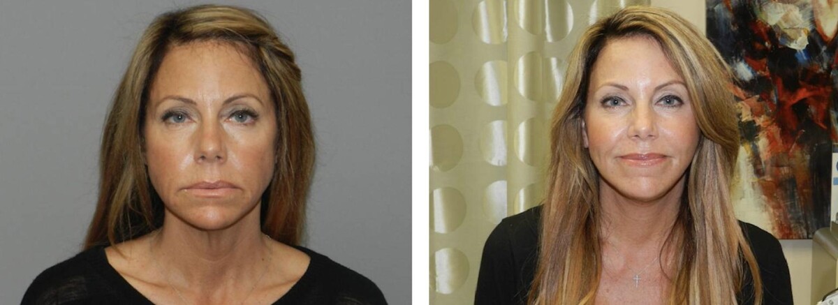 Images Newport Plastic and Reconstructive Surgery Associates: Dr. Hisham M. Seify