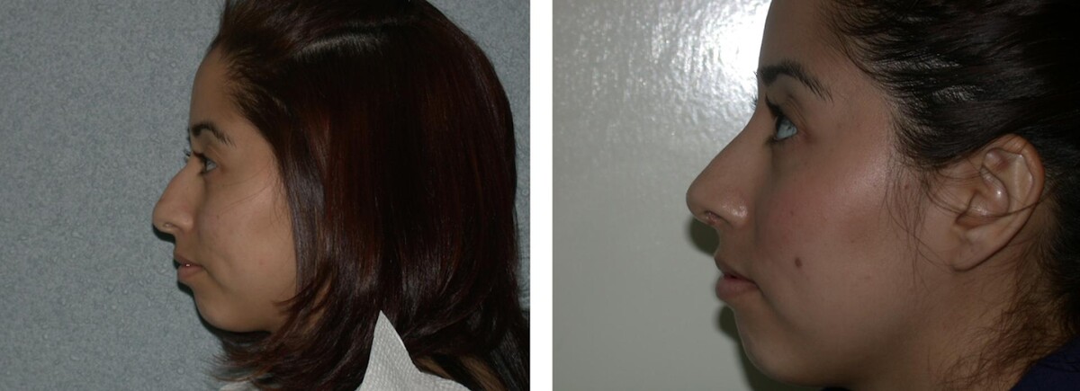 Images Newport Plastic and Reconstructive Surgery Associates: Dr. Hisham M. Seify