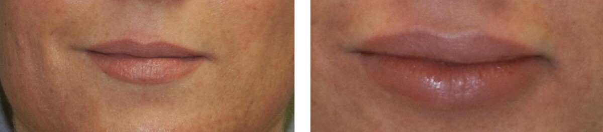 Images Newport Plastic and Reconstructive Surgery Associates: Dr. Hisham M. Seify