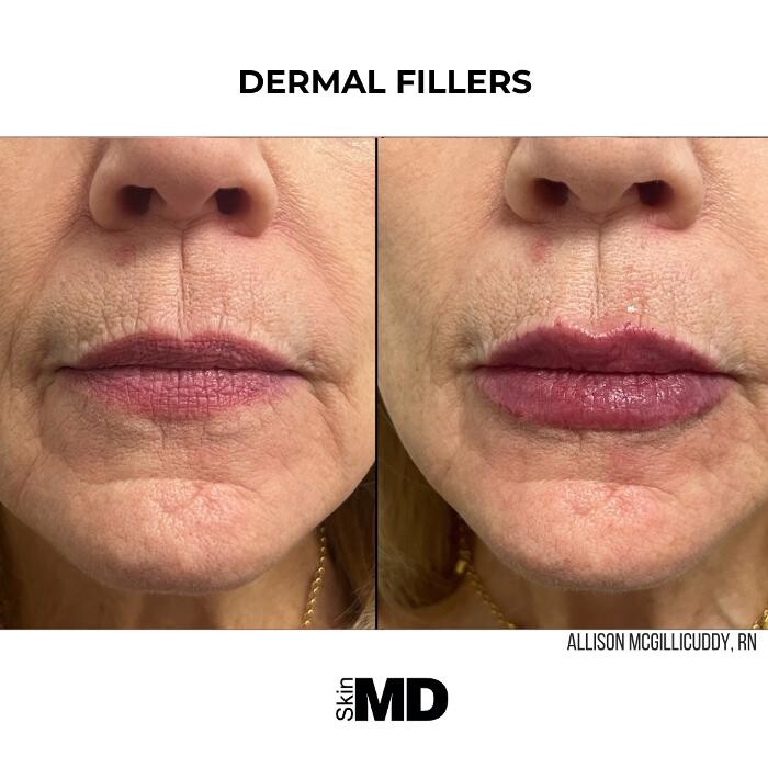Images SkinMD Boston