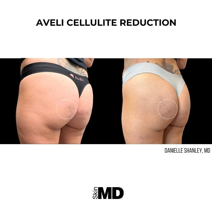 Images SkinMD Boston