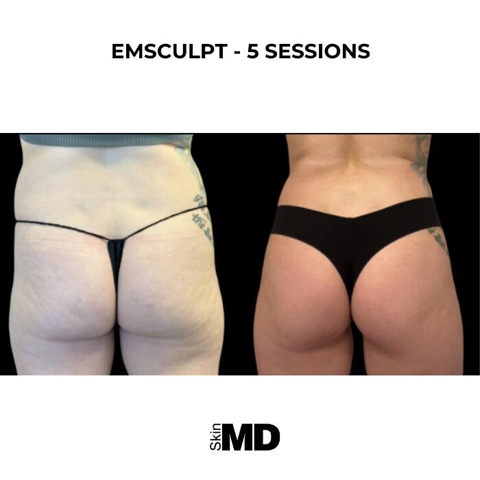 Images SkinMD Boston