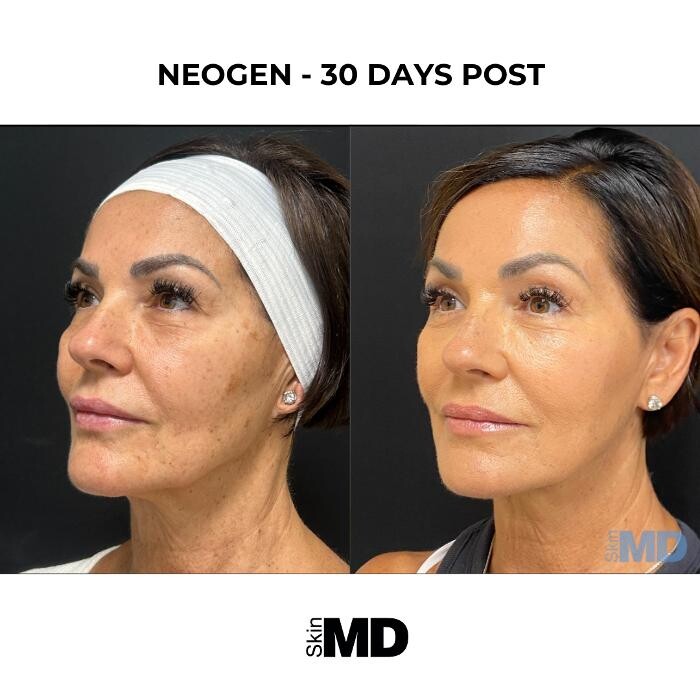 Images SkinMD Boston