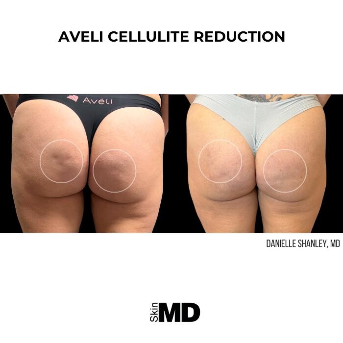 Images SkinMD Boston