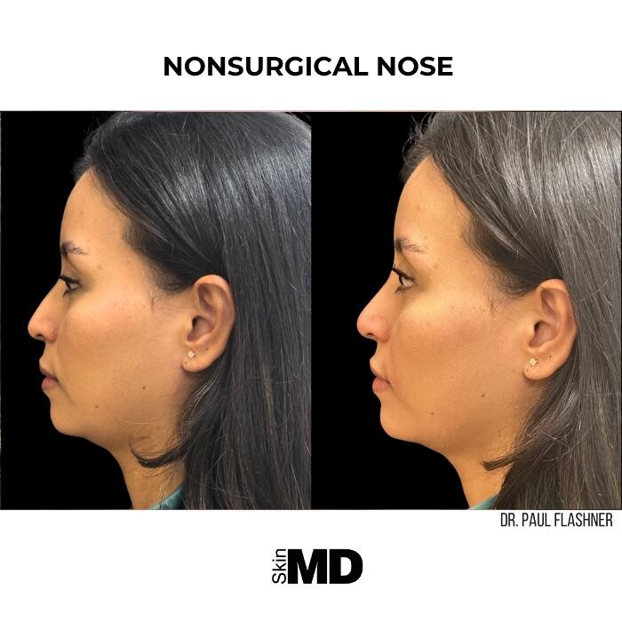 Images SkinMD Boston