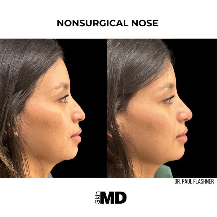 Images SkinMD Boston