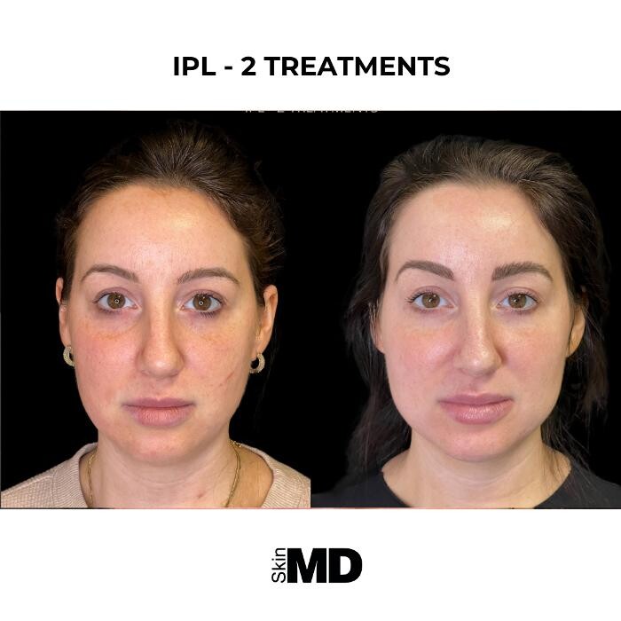 Images SkinMD Boston