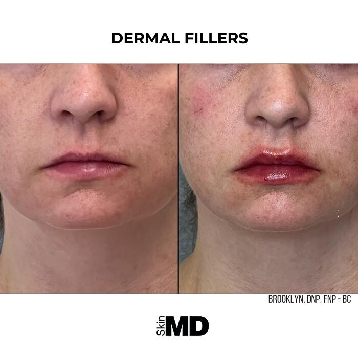 Images SkinMD Boston