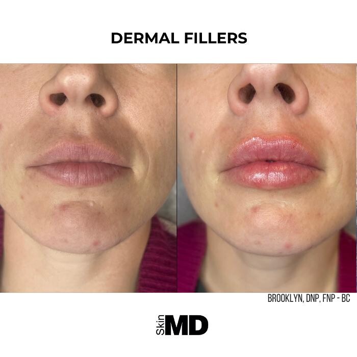 Images SkinMD Boston