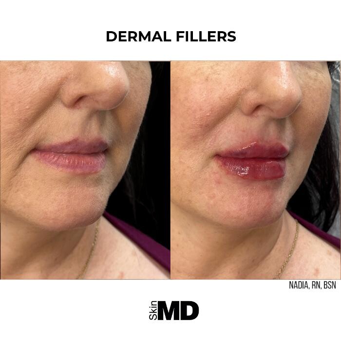 Images SkinMD Boston