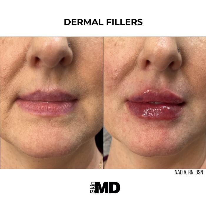 Images SkinMD Boston