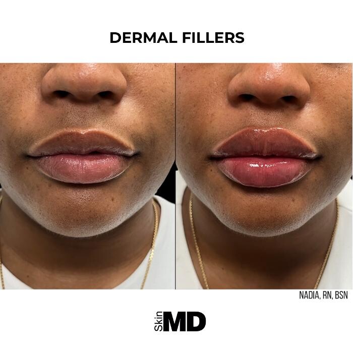 Images SkinMD Boston