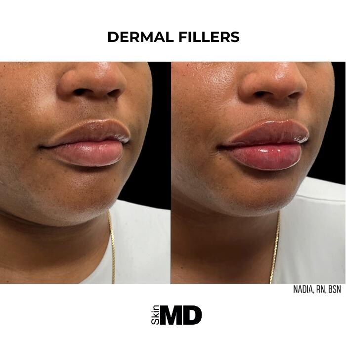 Images SkinMD Boston