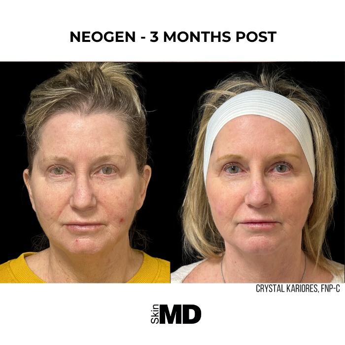 Images SkinMD Boston
