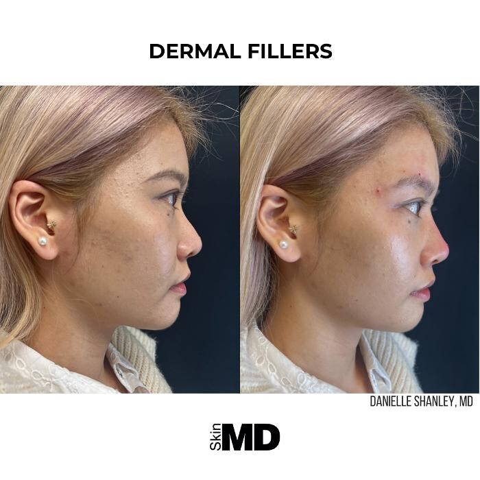 Images SkinMD Boston