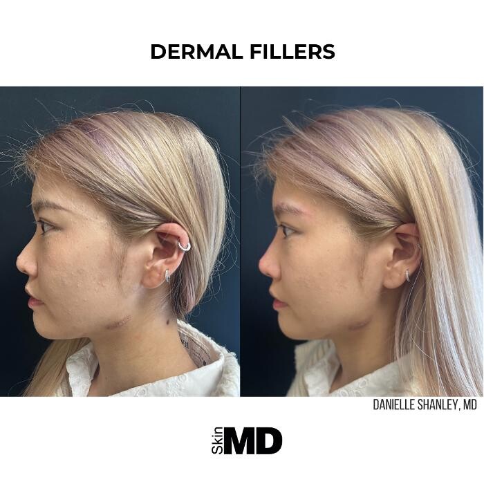 Images SkinMD Boston