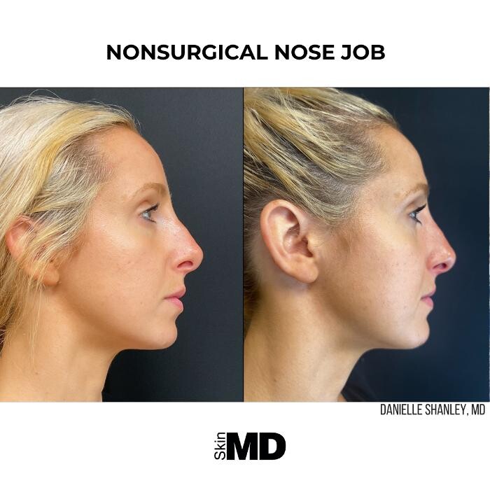 Images SkinMD Boston