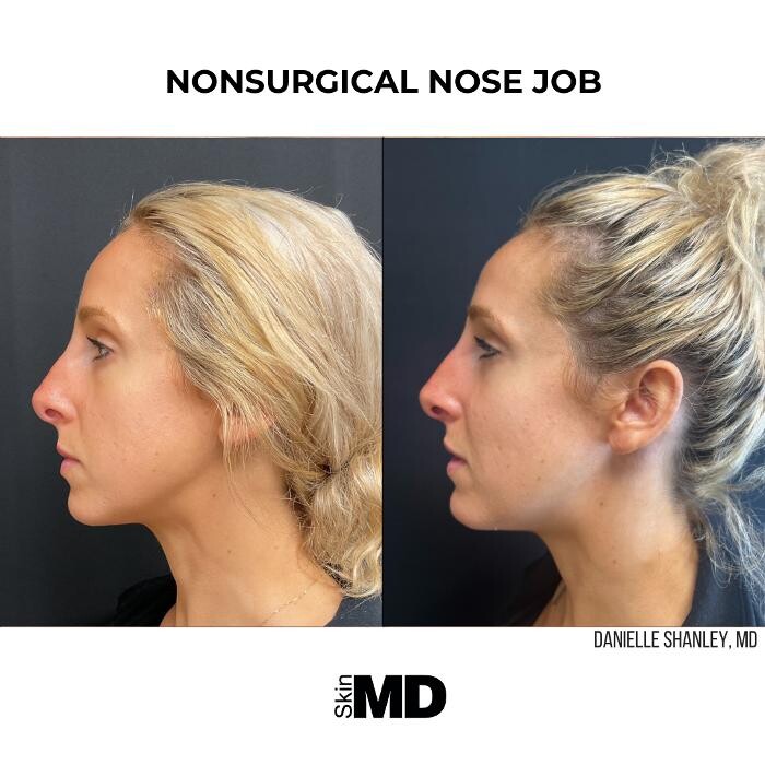 Images SkinMD Boston
