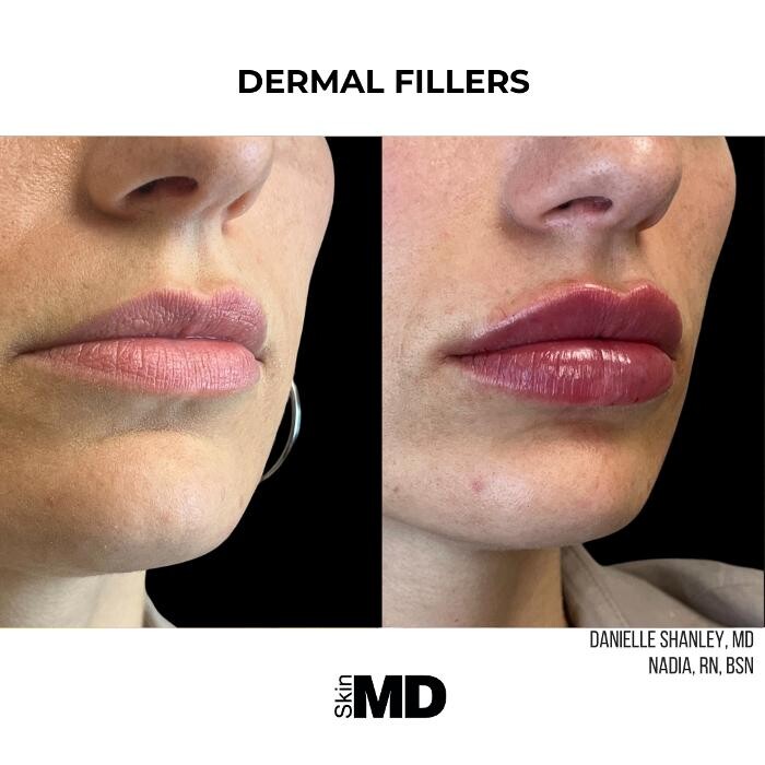 Images SkinMD Boston
