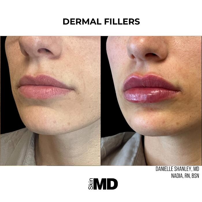 Images SkinMD Boston