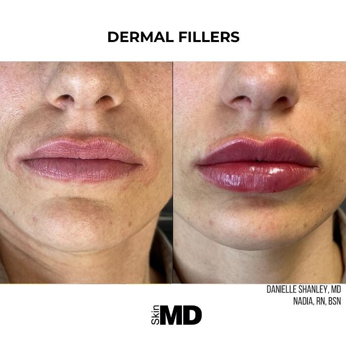 Images SkinMD Boston