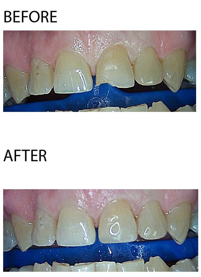 Images Mark Luzania, DDS