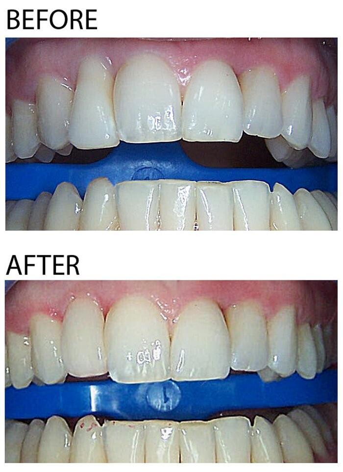 Images Mark Luzania, DDS