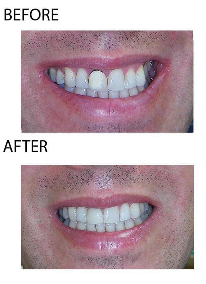 Images Mark Luzania, DDS
