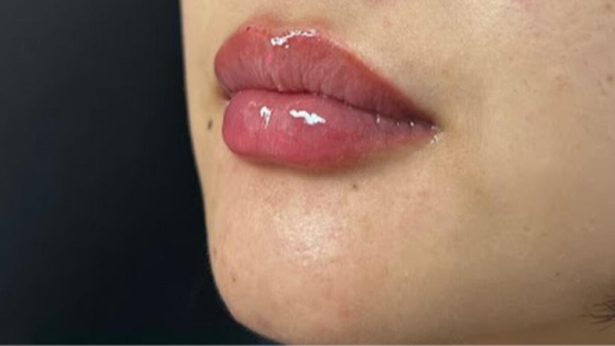 Images Zen Luxe Medspa & IV Lounge