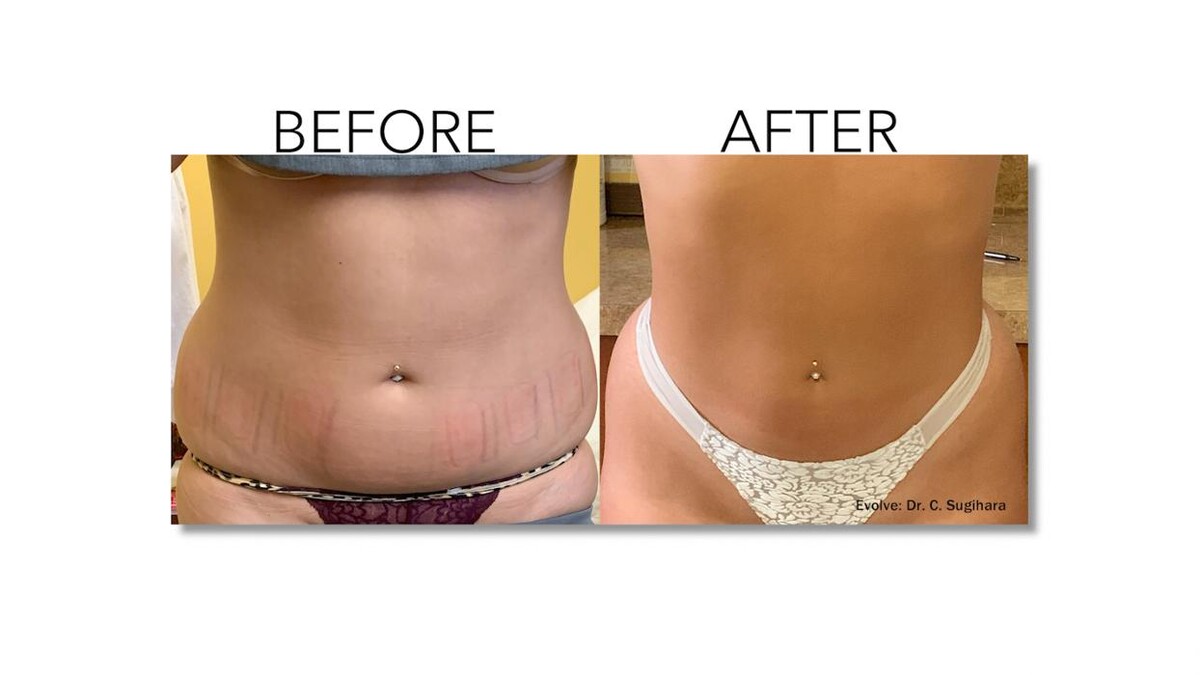 Images Revitalize IV Solutions & MedSpa