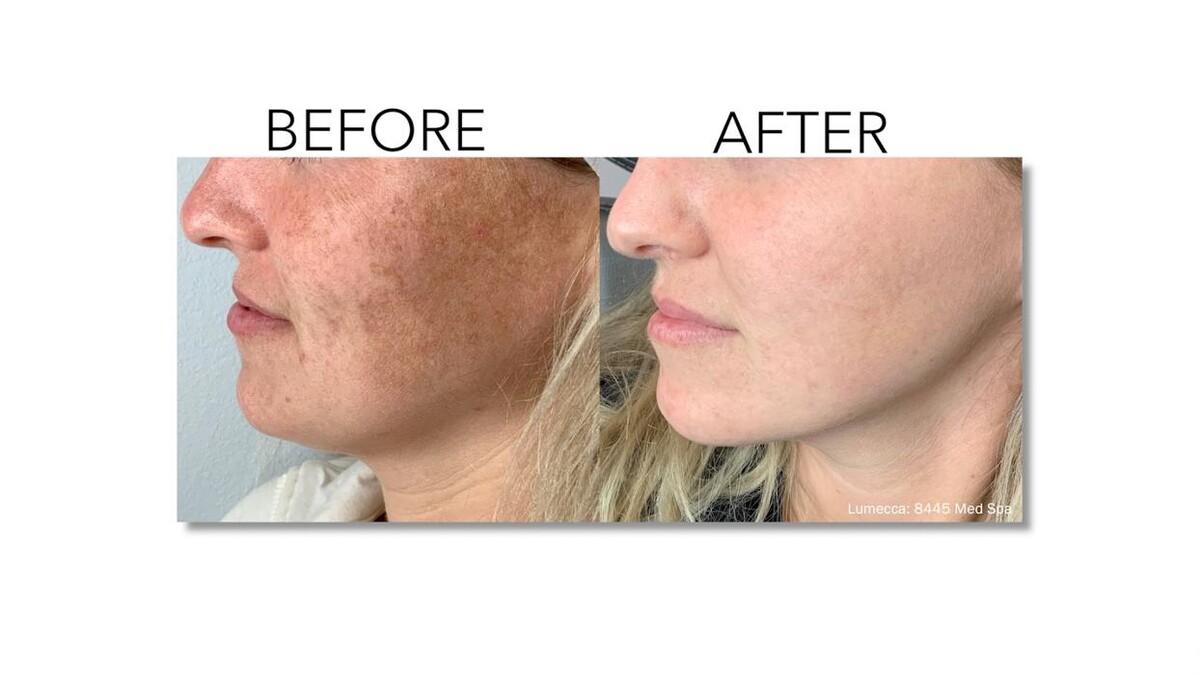 Images Revitalize IV Solutions & MedSpa