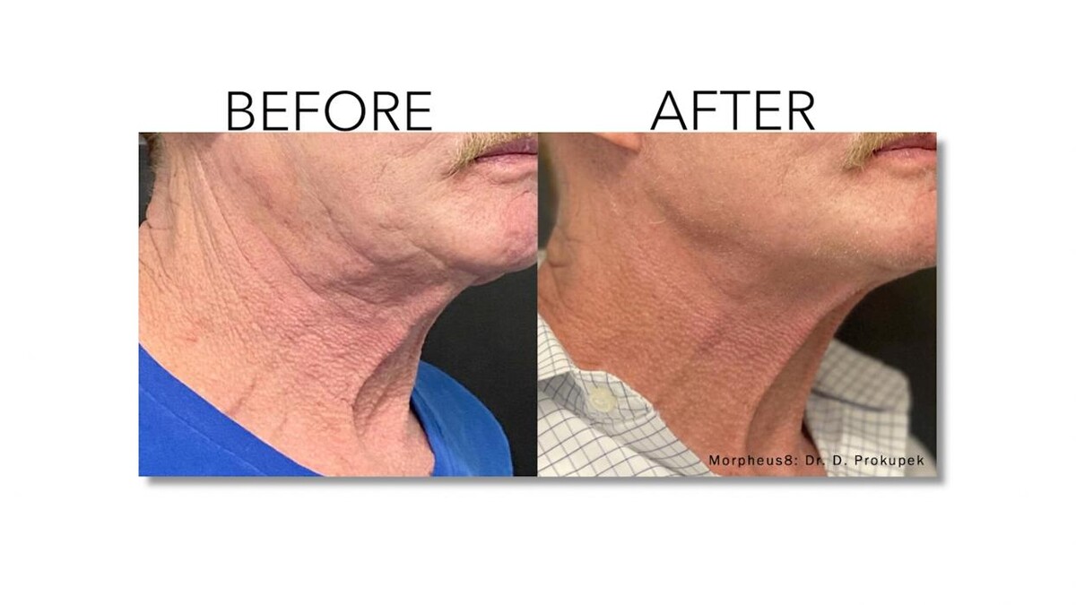 Images Revitalize IV Solutions & MedSpa