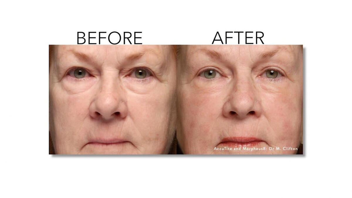 Images Revitalize IV Solutions & MedSpa