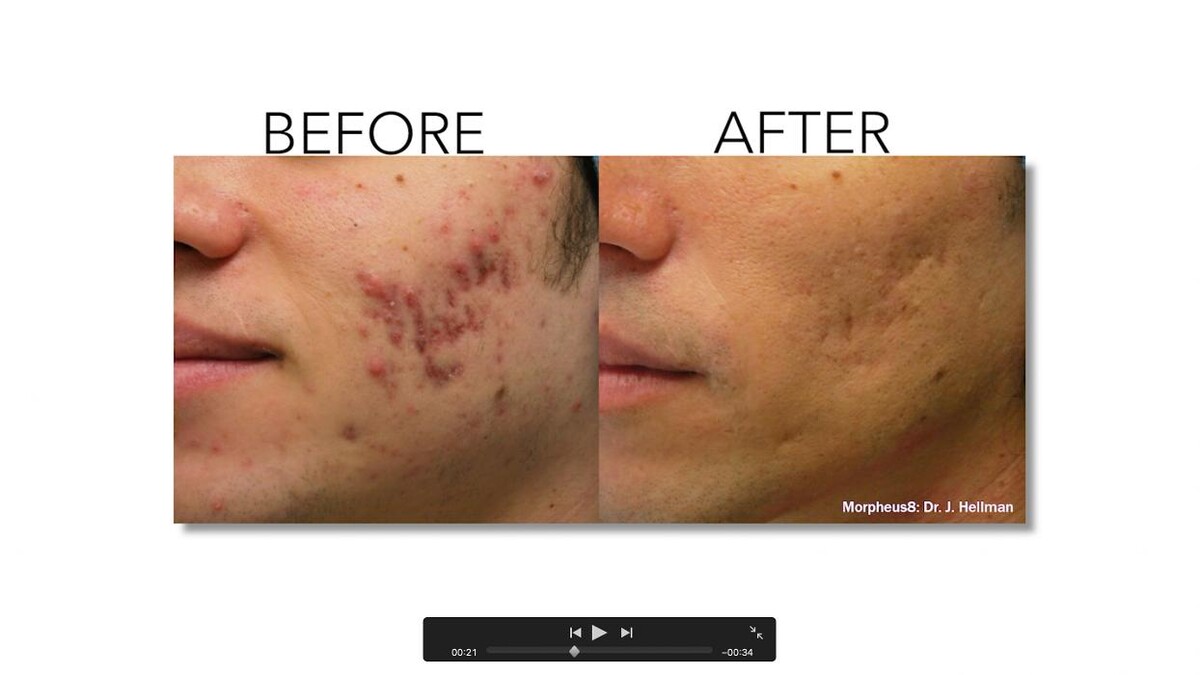 Images Revitalize IV Solutions & MedSpa
