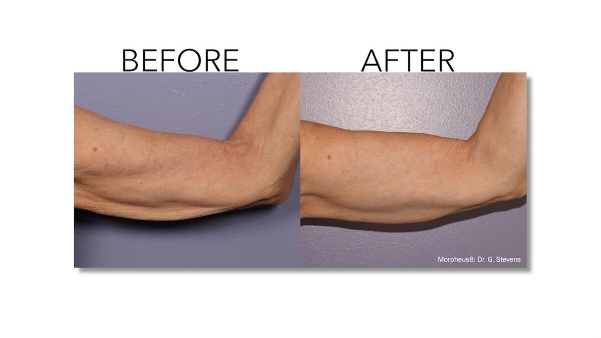 Images Revitalize IV Solutions & MedSpa