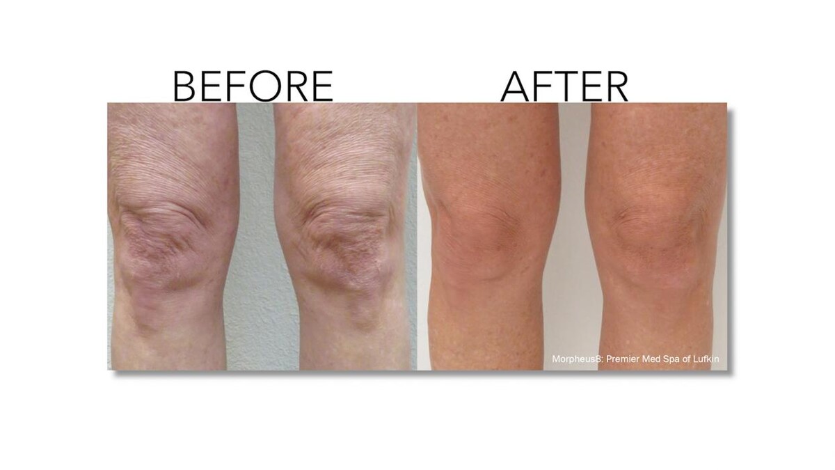 Images Revitalize IV Solutions & MedSpa