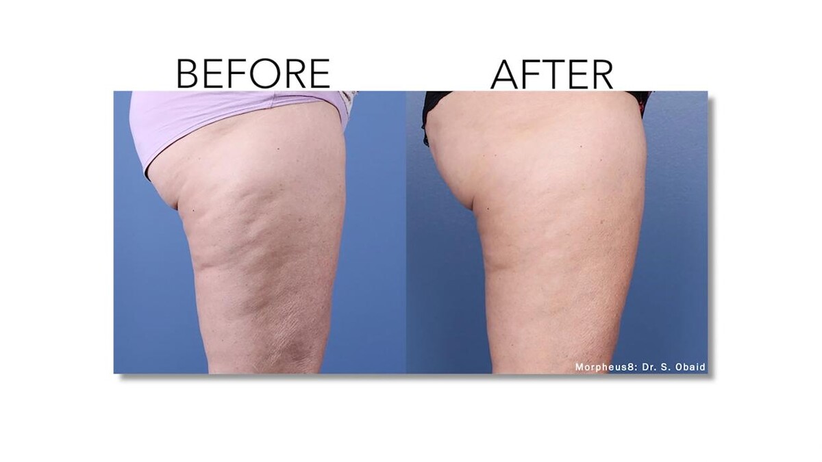 Images Revitalize IV Solutions & MedSpa
