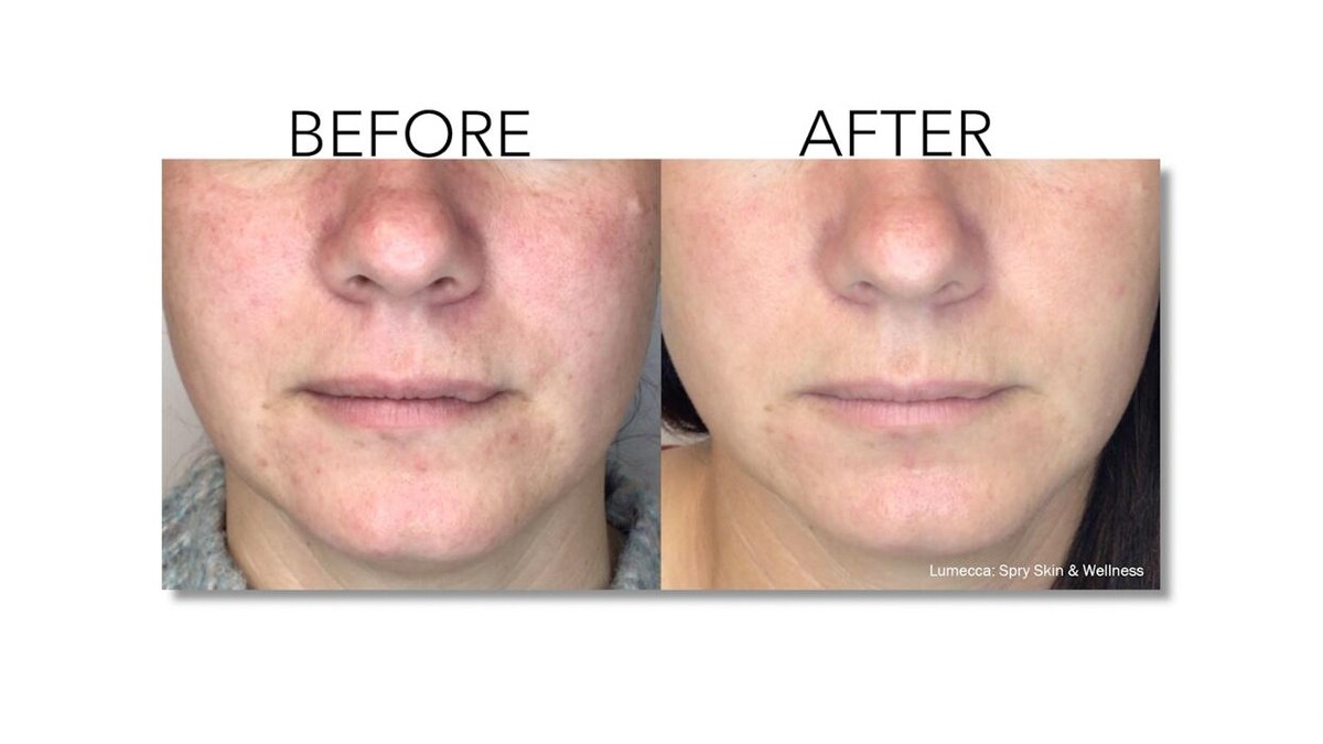 Images Revitalize IV Solutions & MedSpa