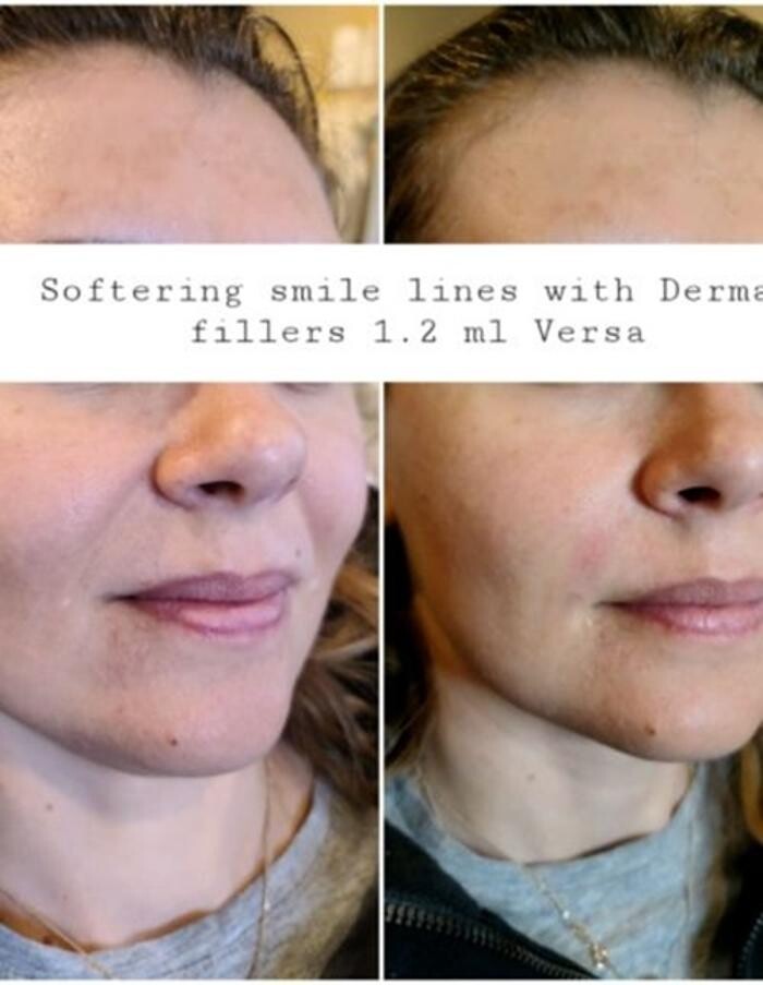 Images Injections By Sabina