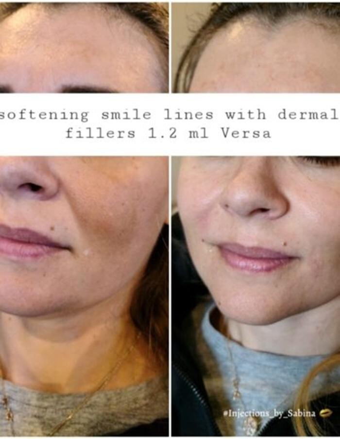 Images Injections By Sabina