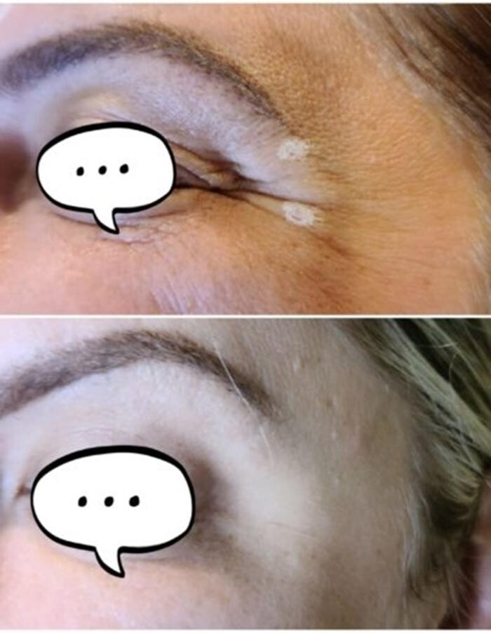 Images Injections By Sabina