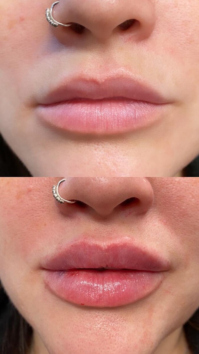 Images Blush Med Spa