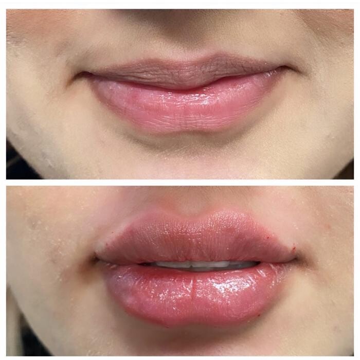 Images Blush Med Spa