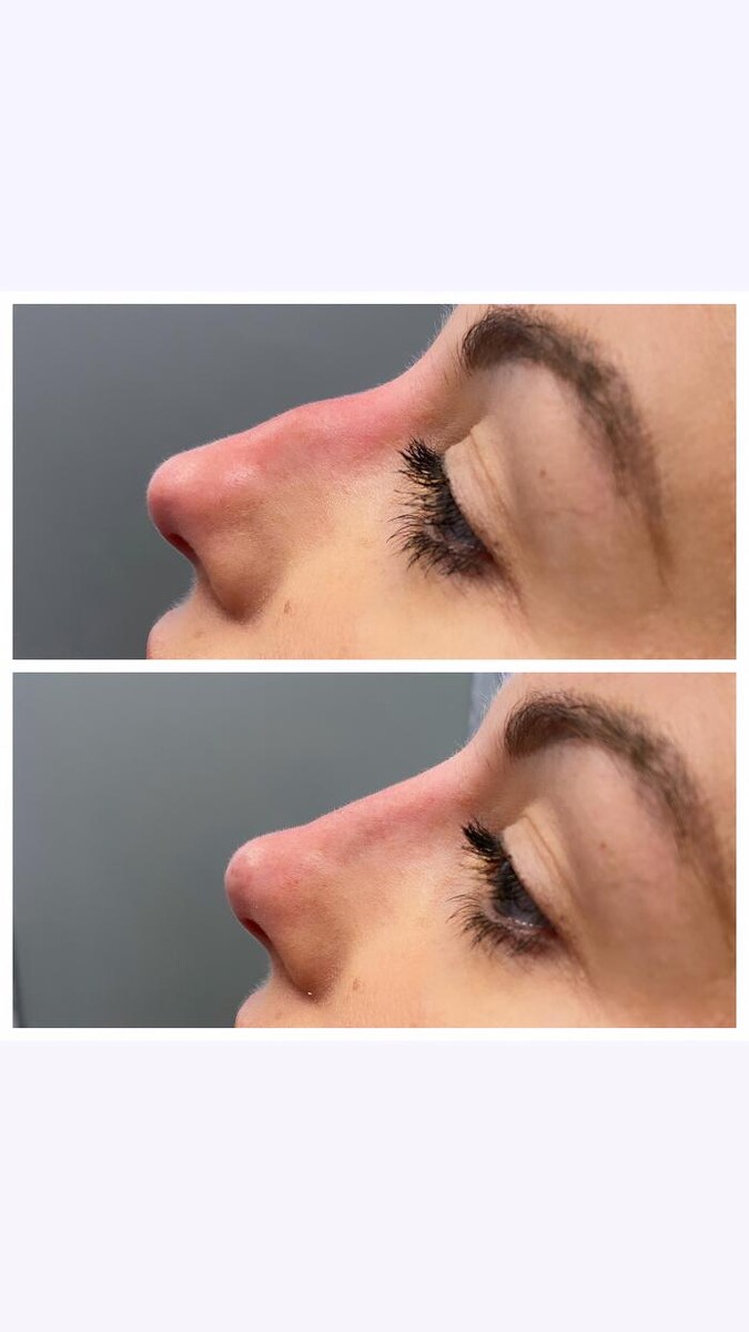 Images Blush Med Spa