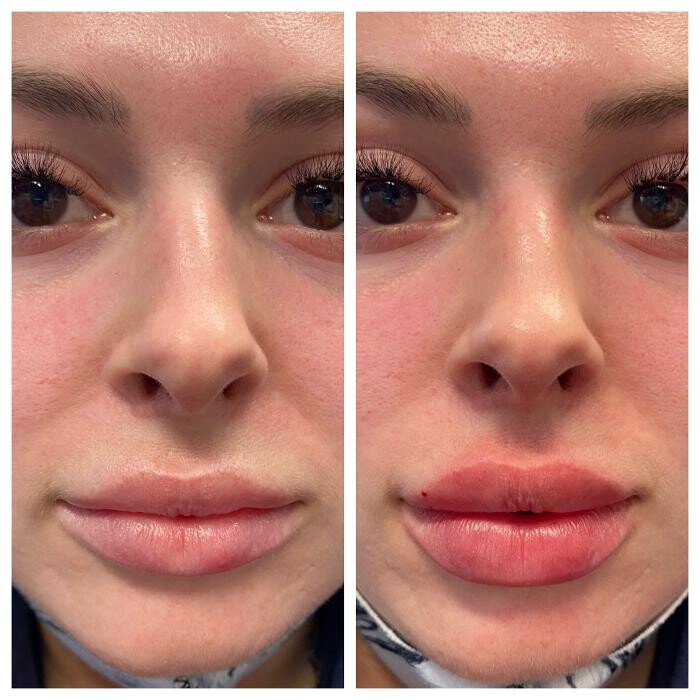 Images Blush Med Spa