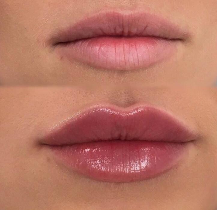 Images Blush Med Spa